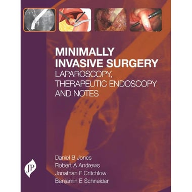 Minimally Invasive Surgery - Laparoscopy, Therapeutic Endoscopy and Notes