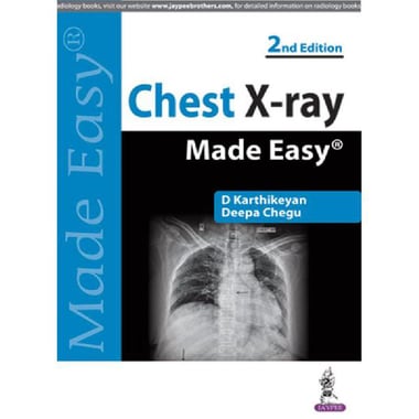 Chest X‎-‎ray Made Easy، ‎2‎nd Edition