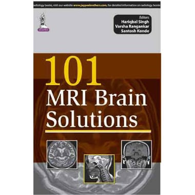 101 Mri Brain Solutions